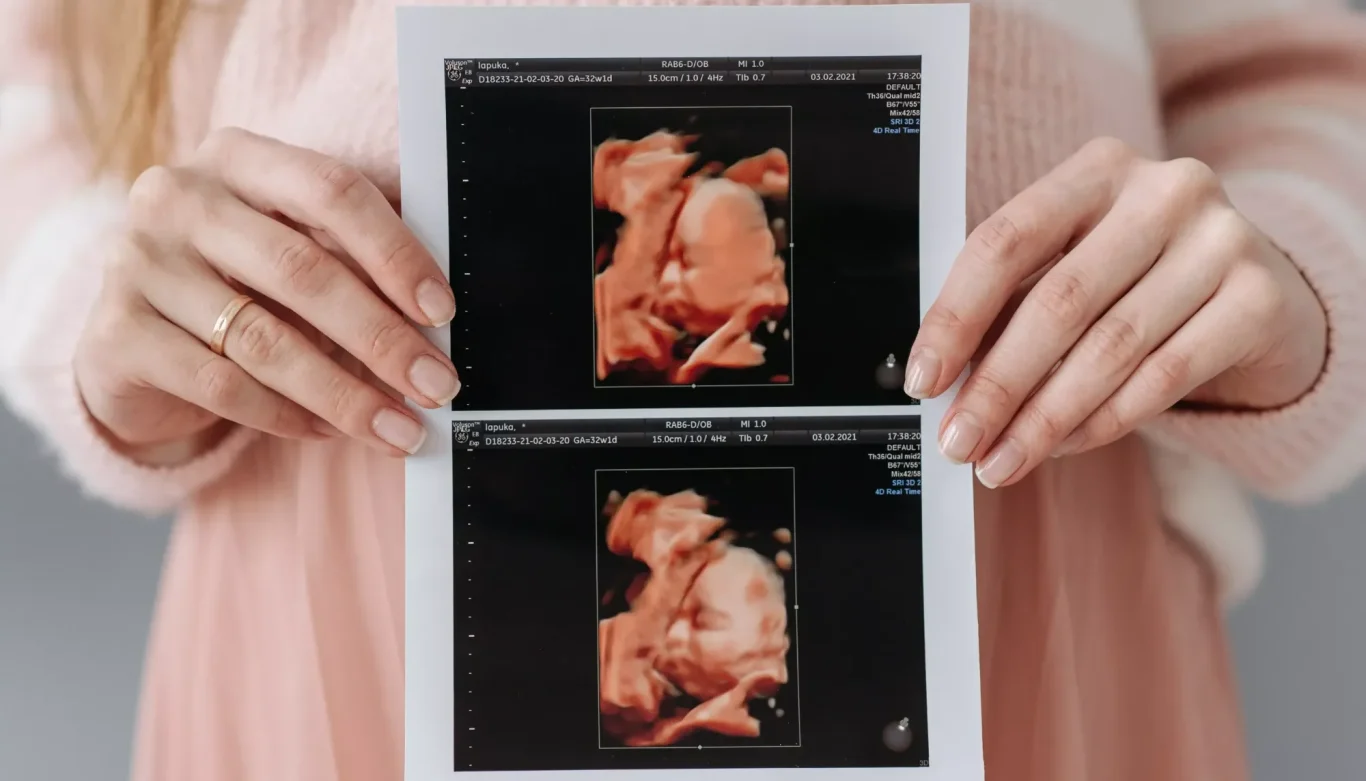 Donna che tiene in mano una foto del esame ecografico fetale
